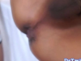 Asian MD slams patient after enema gay porn doctor asian